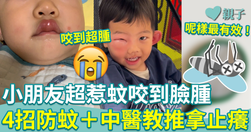 防蚊貼士︱小朋友超惹蚊咬到口腫面腫　4招防蚊＋中醫止癢推拿　呢樣最有效！
