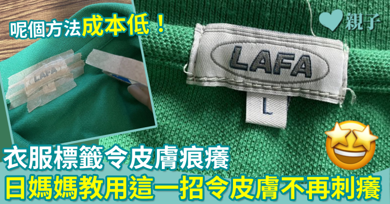 衣服標籤令皮膚痕癢　日媽媽教用這一招　成本低令皮膚不再刺癢