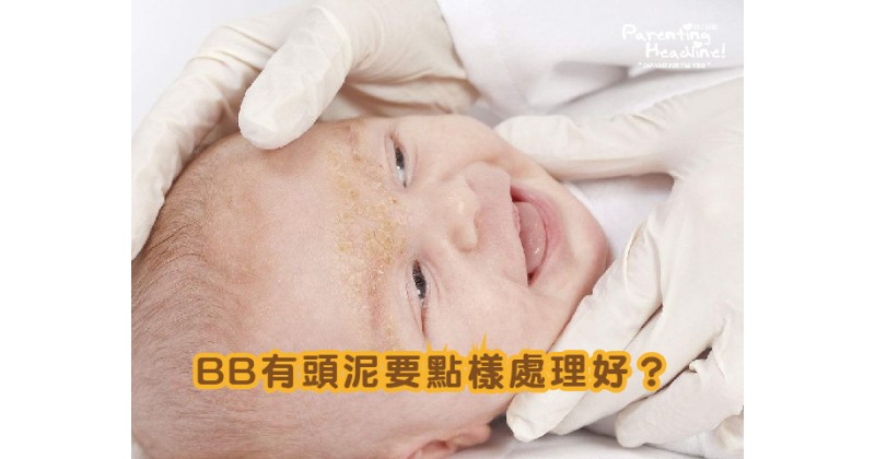 【拆解原因】點解BB有頭泥？ 