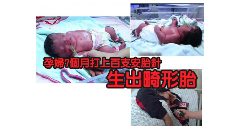【崩潰】孕婦7個月打上百支安胎針 生出畸形胎
