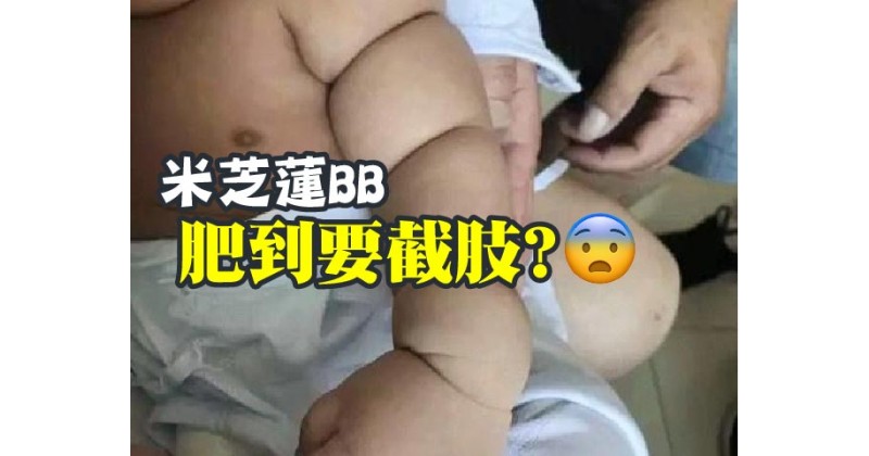 【米芝蓮BB】肥到要截肢?