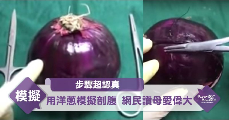 【步驟超認真】用洋蔥模擬剖腹 網民讚母愛偉大
