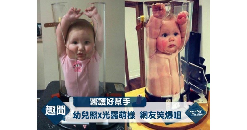 【醫護好幫手】幼兒照X光露萌樣 網友笑爆咀