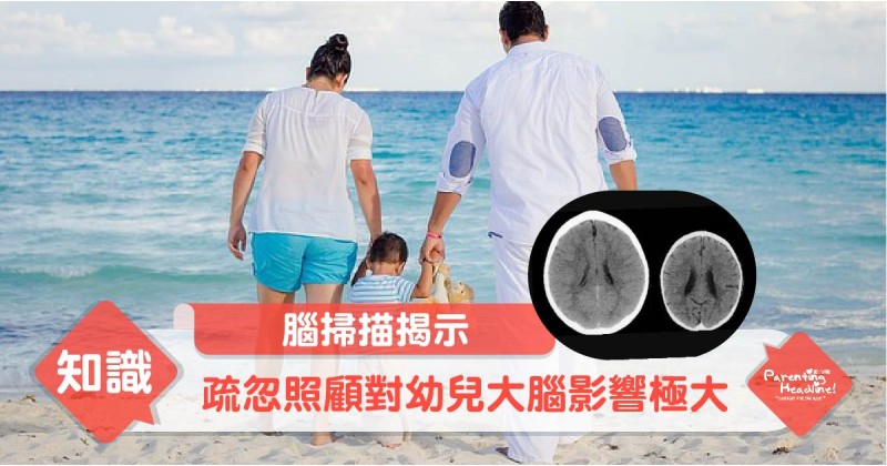 【腦掃描揭示】疏忽照顧對幼兒大腦影響極大