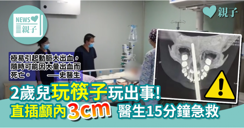 【家長指引】2歲兒玩筷子玩出事！直插顱內3cm醫生15分鐘急救