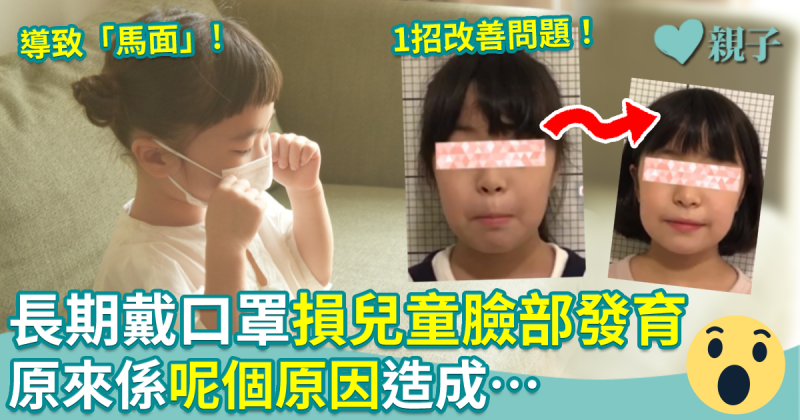 日本牙醫：長期戴口罩損兒童臉部發育　原來係呢個原因造成…