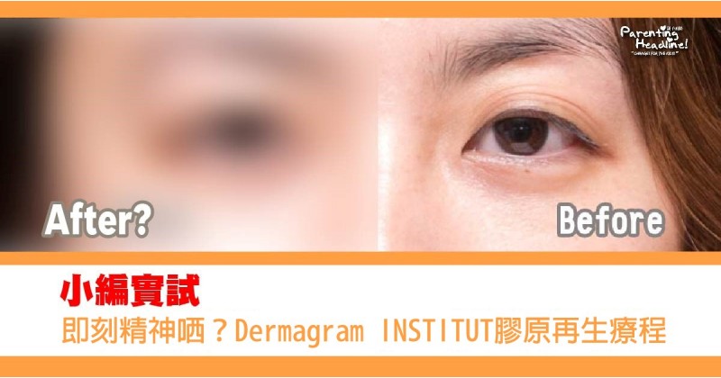 【小編實試】即刻精神哂？Dermagram INSTITUT膠原再生療程